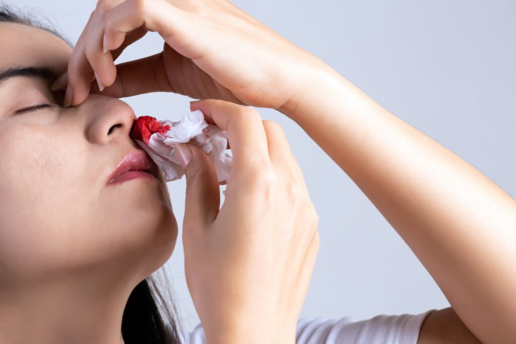 Does Stress Cause Nosebleeds? What You Need to Know